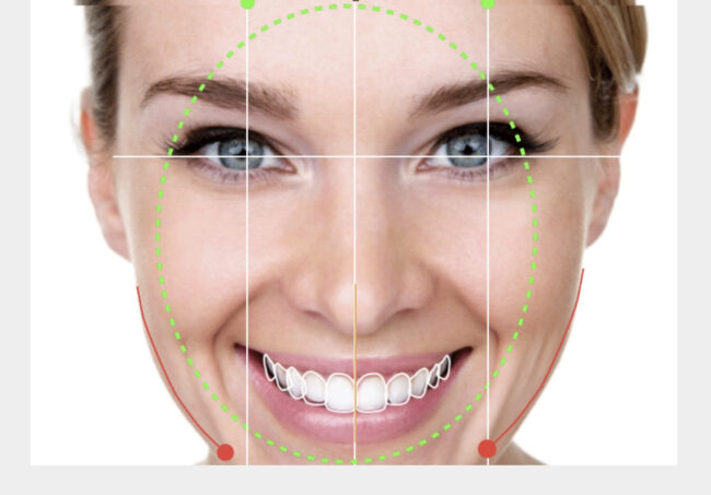 diseño digital de sonrisa