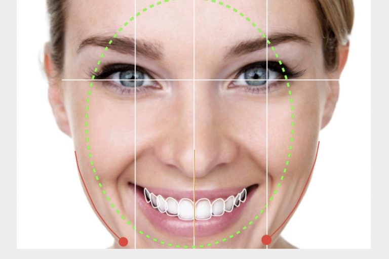 diseño digital de sonrisa