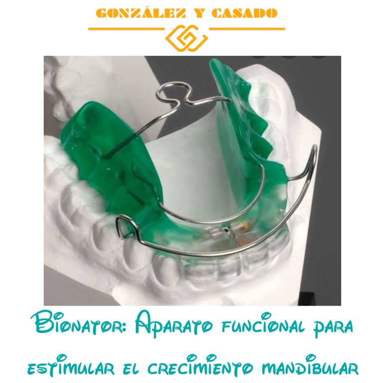 Ortodoncia para niños en Madrid centro