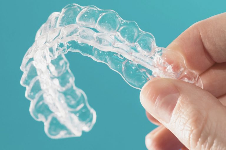 retenedores de ortodoncia en madrid