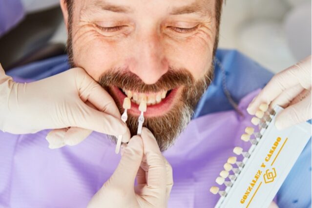 ¿Cómo eliminar las manchas de tetraciclina en los dientes?