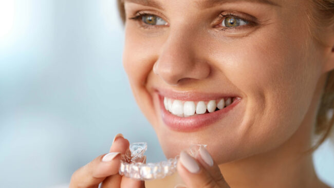 comparativa brackets ortodoncia invisible