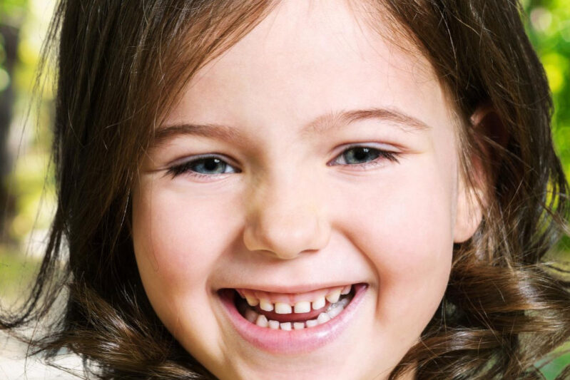 odontología para niños