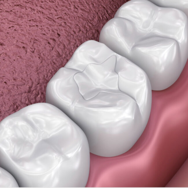 empastes dentales