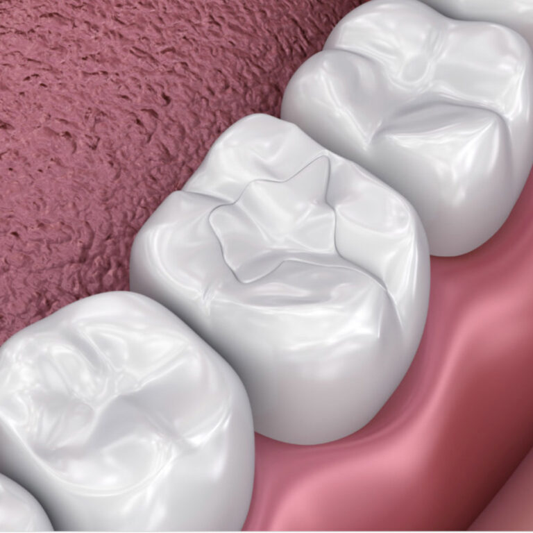 empastes dentales