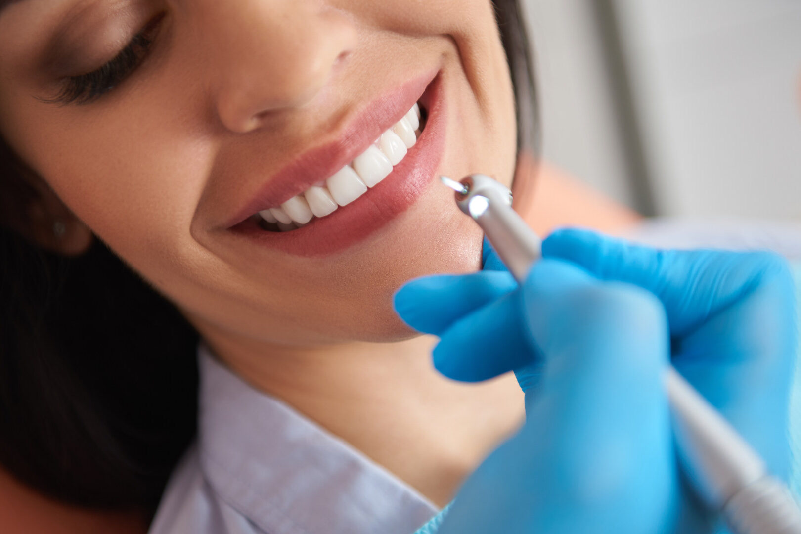 endodoncia dental en madrid clínica dental