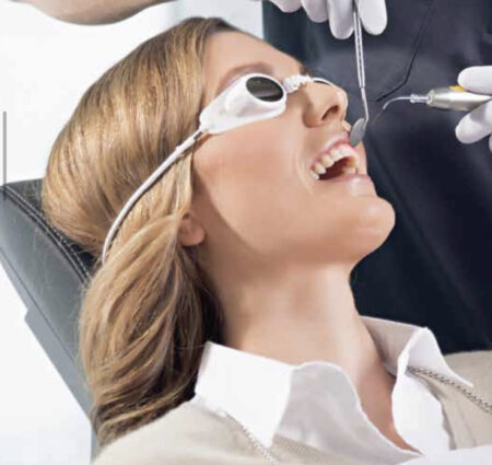 gingivectomía láser