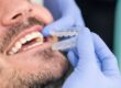 cuántas horas al día alineadores dentales