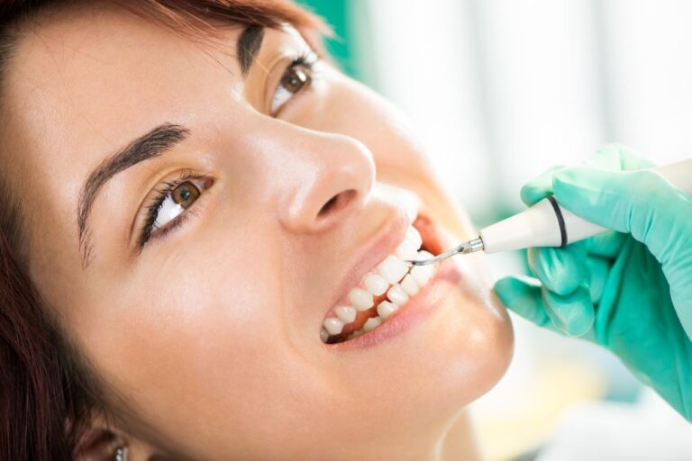 mejor clínica limpieza dental en madrid