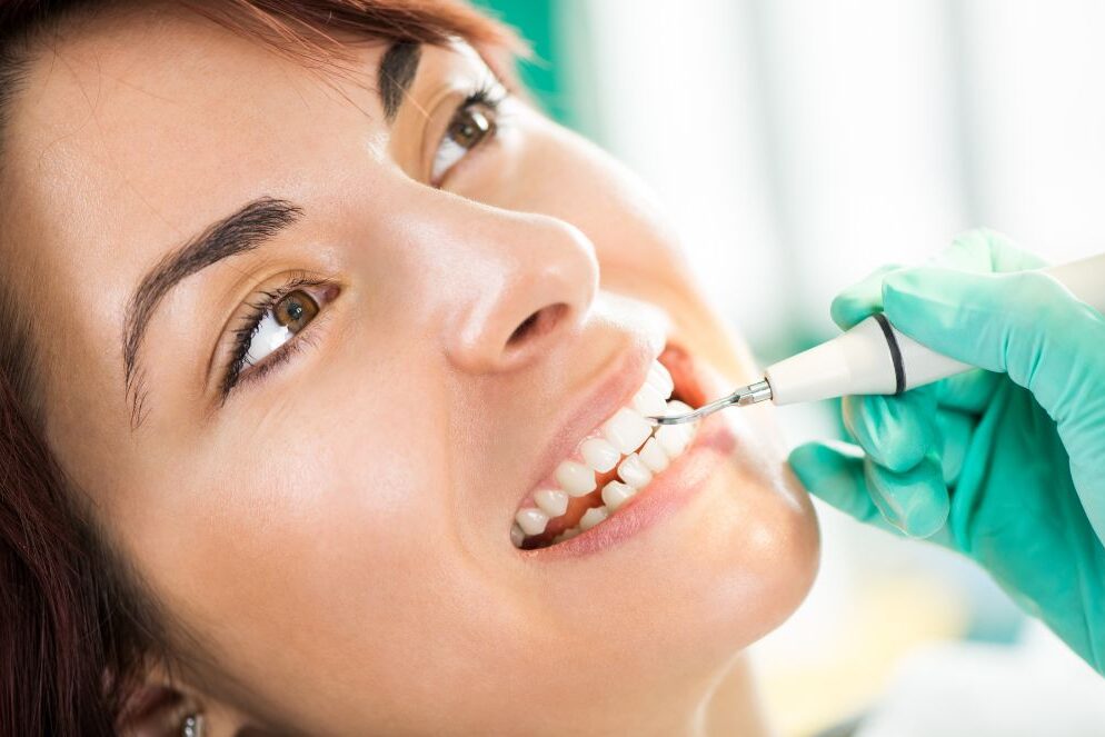 mejor limpieza dental madrid mejor clínica limpieza dental en madrid
