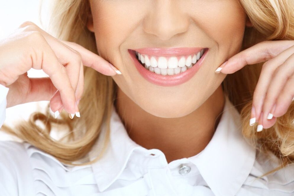 qué comer después de un blanqueamiento dental