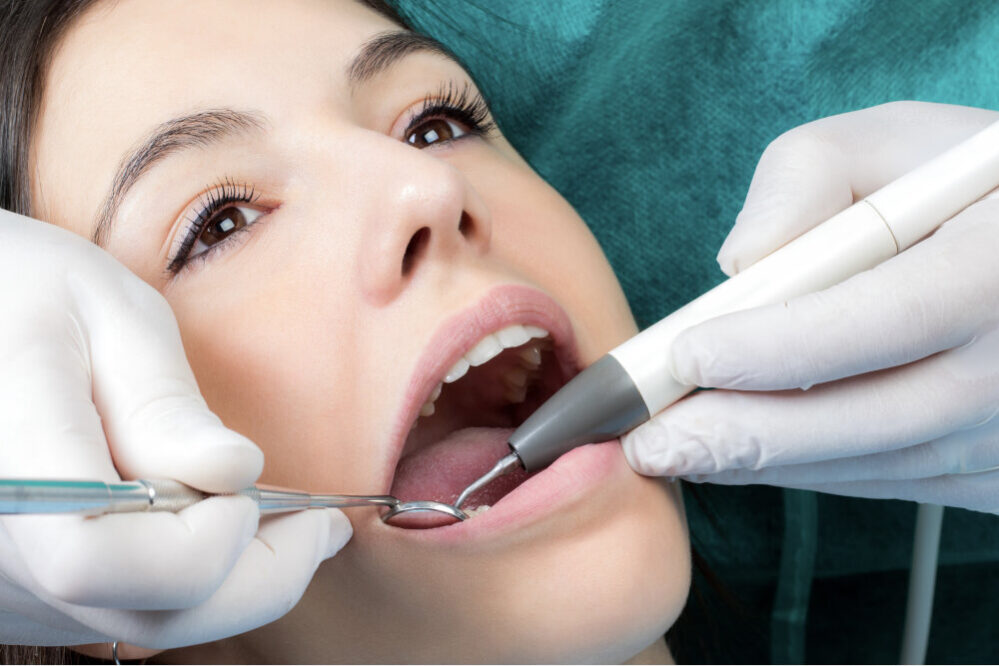 cuántas limpiezas dentales puedo hacerme al año