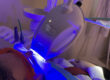 blanqueamiento dental luz led madrid