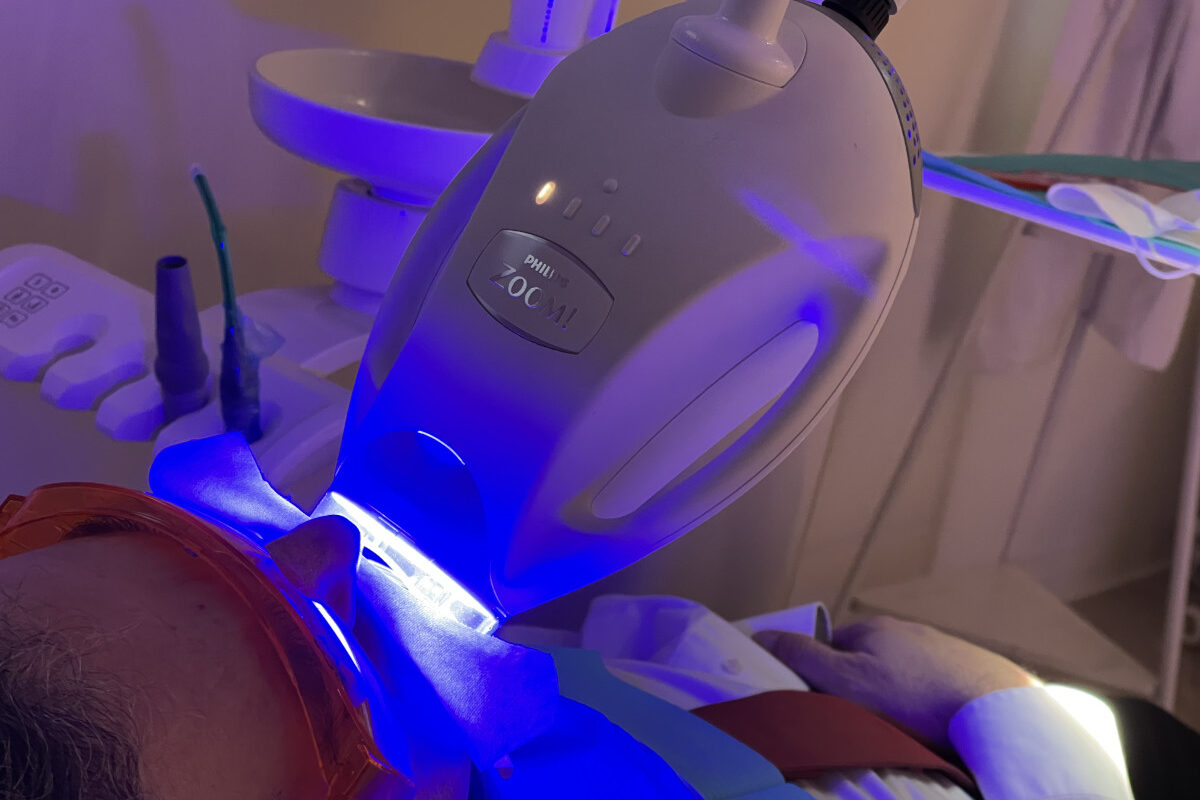 blanqueamiento dental luz led madrid