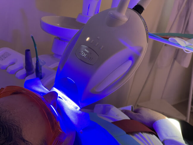 blanqueamiento-luz-led-madrid-1 blanqueamiento dental luz led madrid