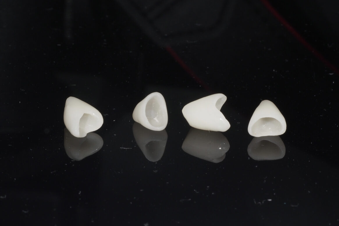 qué es una corona provisional