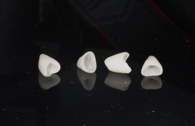 qué es una corona provisional