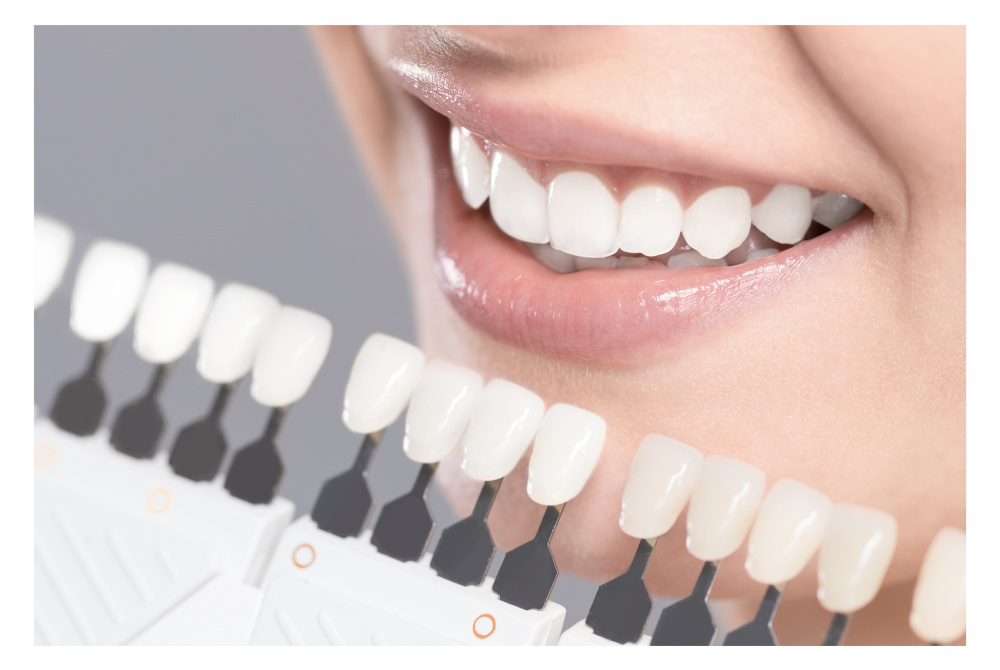 qué es una corona provisional