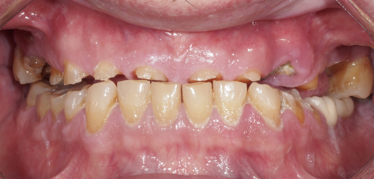 estrés salud dental