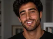 implantes dentales como tratamiento para la agenesias